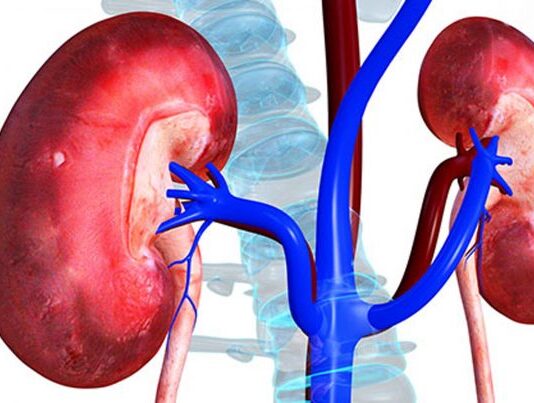 स्वस्थ मिर्गौलाका लागि ७ मन्त्र: के गर्ने, के नगर्ने?